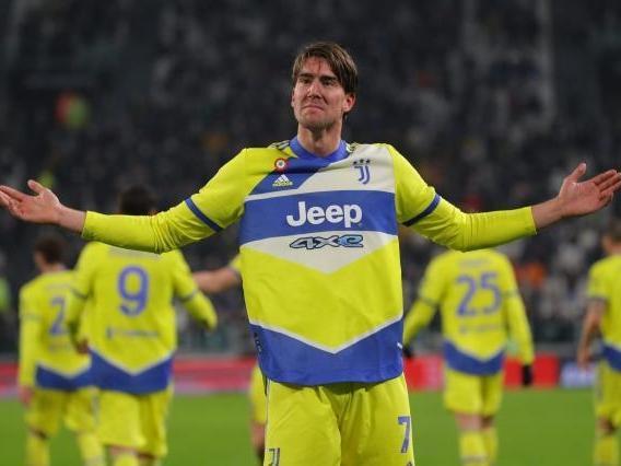 腹侧纹状体 腹侧纹状体